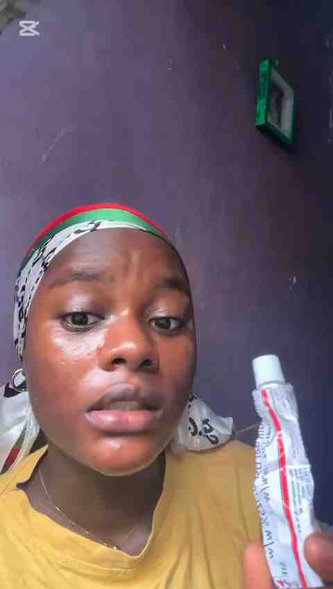 My experience with tretinoin